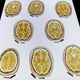 Preserved slices of a human brain for sale to institutions in Germany. (Photo: Getty)